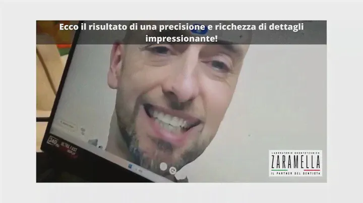 MetiSmile 3D Face Scanner shining test presso il laboratorio zaramella srl