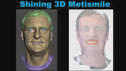 First Time Scanning with the Shining 3d Metismile Facial Scanner